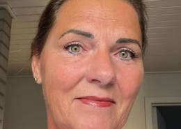 akupunktur Holbæk