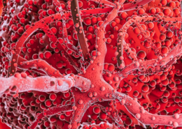 inflammation