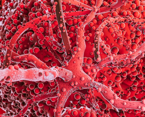 inflammation