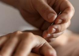 Medicinsk akupunktur